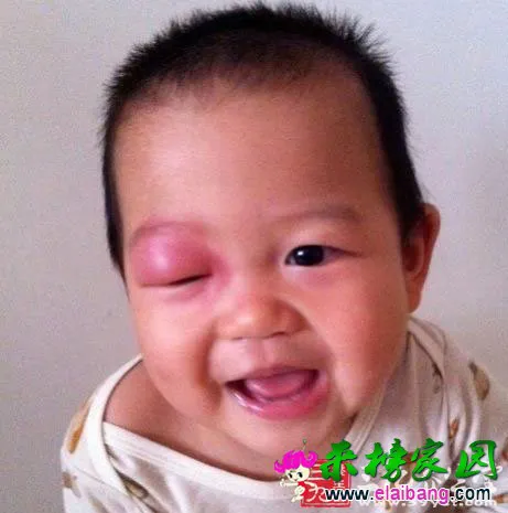 15094U126-0.webp