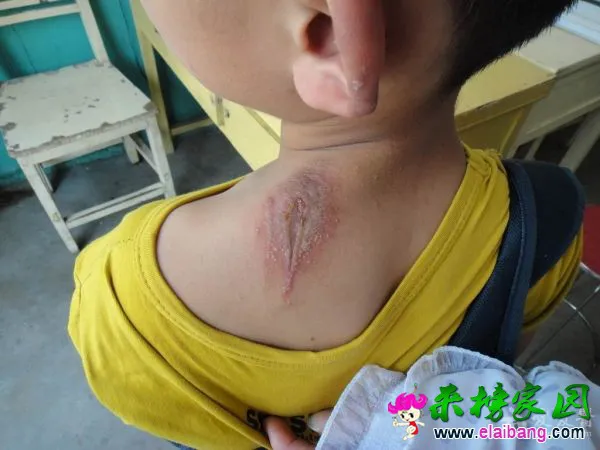 1205231046da3247ea9d4f9e2d.webp.thumb.webp
