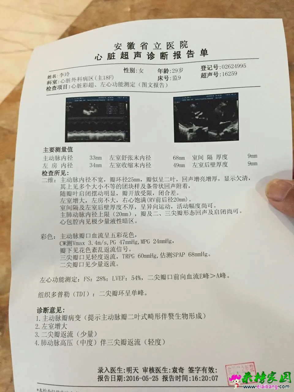 QQ图片20160529100003.webp