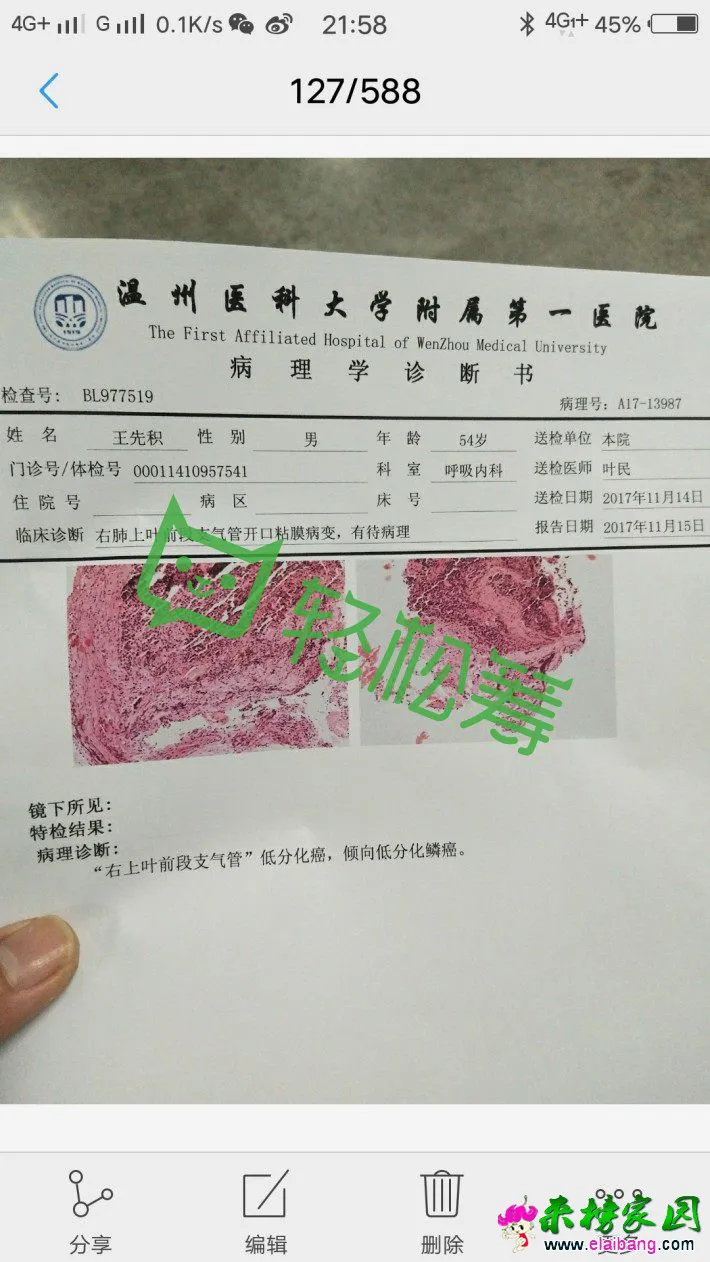 微信图片_20180108065800.webp